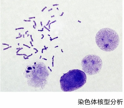 人体染色体显微镜图图片