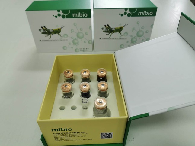 MMP9 Elisa 上海酶联生物试剂盒真的好