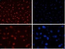 大鼠肝星状细胞  Rat hepatic stellate cells