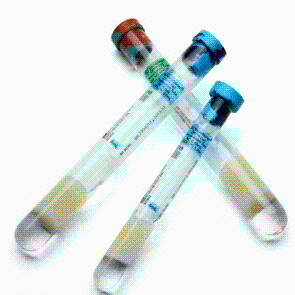 BD 362761 Vacutainer®单核细胞制备管/PRP采血guan 产品图片